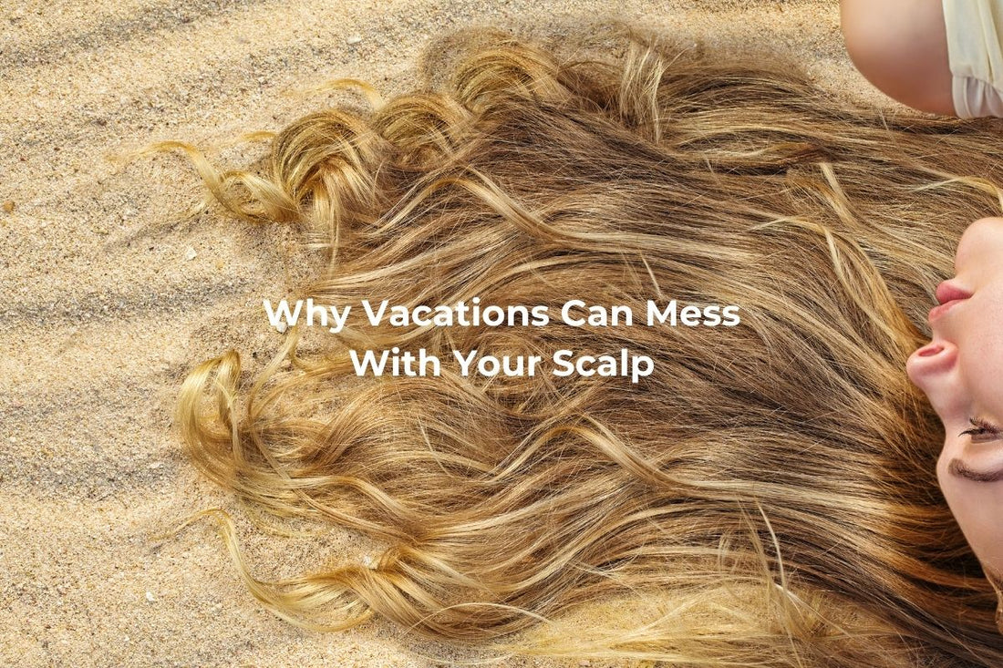 Vacay Scalp Triggers (and How to Outsmart Them)